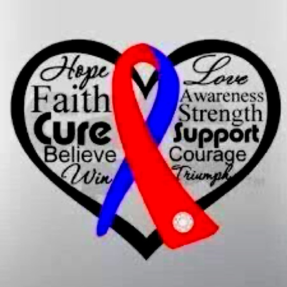 CHD Hypoplastic Right Heart Syndrome and Tricuspid Artesia.